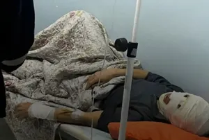 Мужчина получил ожоги на АЗС в Бейнеуском районе
