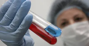 Число больных корью в Европе увеличилось в четыре раза